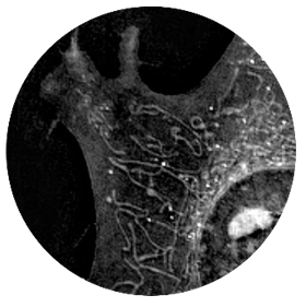 Mitochondria label-free live cell imaging